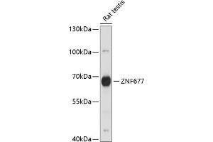 Western blot analysis of extracts of rat testis, using ZNF677 antibody (ABIN7271518) at 1:1000 dilution. (ZNF677 antibody  (AA 50-200))