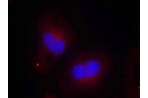 Immunofluorescence staining of methanol-fixed Hela cells using FAK(Phospho-Tyr925) Antibody. (FAK antibody  (pTyr925))