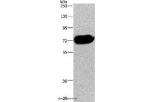 Western blot analysis of Human pancreas tissue, using CDC16 Polyclonal Antibody at dilution of 1:250 (CDC16 antibody)