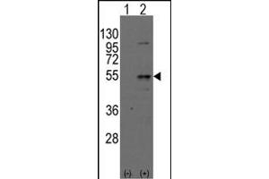 Western blot analysis of Dtnbpt(arrow) using rabbit polyclonal Dysbindin(Dtnbp1) Antibody (N-term) (ABIN389169 and ABIN2839335). (DTNBP1 antibody  (N-Term))