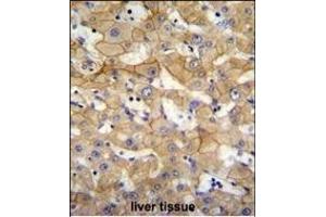 SCA5 Antibody (Center) (ABIN655746 and ABIN2845192) immunohistochemistry analysis in formalin fixed and raffin embedded human liver tissue followed by peroxidase conjugation of the secondary antibody and DAB staining. (SPACA5 antibody  (AA 40-69))