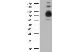 Western Blotting (WB) image for anti-phosphoinositide-3-Kinase Adaptor Protein 1 (PIK3AP1) antibody (ABIN1496827) (PIK3AP1 antibody)