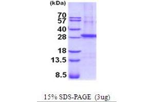 SDS-PAGE (SDS) image for Sarcoglycan, beta (43kDa Dystrophin-Associated Glycoprotein) (SGCB) (AA 87-318) protein (His tag) (ABIN5854245)