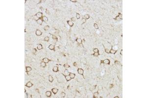 Immunohistochemistry of paraffin-embedded mouse brain using Raptor Rabbit pAb (ABIN7269901) at dilution of 1:150 (40x lens).