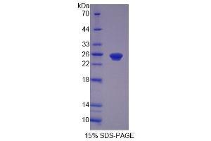 SDS-PAGE analysis of Human PEX1 Protein. (PEX1 Protein)