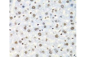 Immunohistochemistry of paraffin-embedded Mouse liver using IGF2BP2 Polyclonal Antibody at dilution of 1:100 (40x lens). (IGF2BP2 antibody)