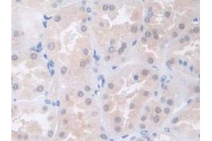 DAB staining on IHC-P; Samples: Human Kidney Tissue (COL4a5 antibody  (AA 1461-1685))