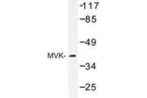 Western blot analysis of MVK antibody in extracts from COS-7 cell.