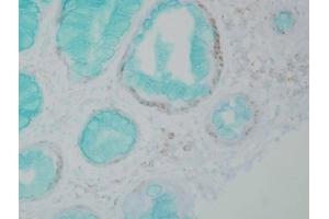 Immunohistochemistry analysis using Mouse Anti-DNMT1 Monoclonal Antibody, Clone 60B1220. (DNMT1 antibody  (AA 637-650))