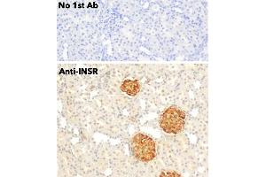 Immunohistochemistry (IHC) image for anti-Insulin Receptor (INSR) (C-Term) antibody (ABIN6254165) (Insulin Receptor antibody  (C-Term))
