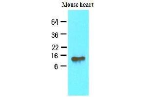Western Blotting (WB) image for anti-Fatty Acid Binding Protein 4, Adipocyte (FABP4) (AA 1-132), (N-Term) antibody (ABIN336086) (FABP4 antibody  (N-Term))