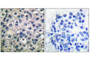 Immunohistochemistry (IHC) image for anti-Breast Cancer Anti-Estrogen Resistance 1 (BCAR1) (pTyr410) antibody (ABIN1847248) (BCAR1 antibody  (pTyr410))