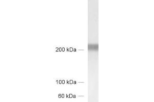 dilution: 1 : 1000, sample: brain homogenate from new born rats (TNC antibody)