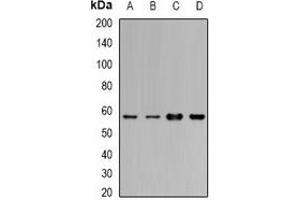 Western blot analysis of Cytochrome P450 1A1 expression in MCF7 (A), BT474 (B), mouse lung (C), mouse liver (D) whole cell lysates. (CYP1A1 antibody)