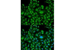 Immunofluorescence analysis of U2OS cells using HSPA1L antibody.