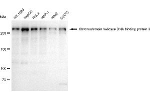 Western blotting analysis using Chromodomain helicase DNA binding protein 3 antibody (ABIN7798068). (Recombinant CHD3 antibody)