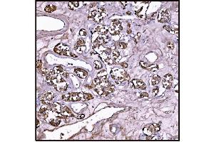 IHC analysis of FABP-1/GOT2 using anti-FABP-1/GOT2 antibody (ABIN7601426). (GOT2 antibody  (AA 35-430))