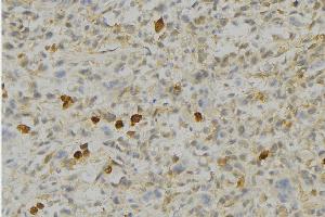 ABIN6276690 at 1/100 staining Human gastric tissue by IHC-P.