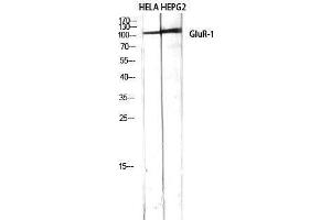 Western Blotting (WB) image for anti-Glutamate Receptor 1 (GLUR1) (Ser43) antibody (ABIN3184806) (Glutamate Receptor 1 antibody  (Ser43))