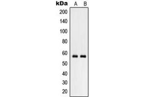Western blot analysis of RHCG expression in NCIH460 (A), human testis (B) whole cell lysates. (RHCG antibody  (Center))