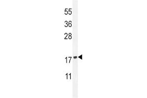 Western Blotting (WB) image for anti-Phospholipase A2, Group IID (PLA2G2D) antibody (ABIN2996055) (PLA2G2D antibody)