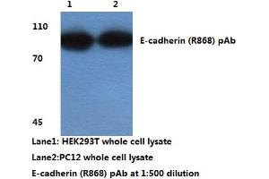 Western blot analysis of E-cadherin (pArg868) (E-cadherin antibody)