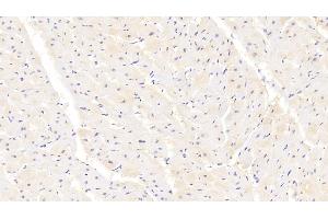 Detection of PPARg in Human Cardiac Muscle Tissue using Polyclonal Antibody to Peroxisome Proliferator Activated Receptor Gamma (PPARg) (PPARG antibody  (AA 349-488))