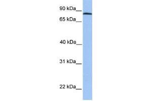 Human HeLa; WB Suggested Anti-ADAM7 Antibody Titration: 0.
