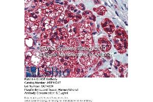 Immunohistochemistry (IHC) image for anti-Hepatocyte Growth Factor (Hepapoietin A, Scatter Factor) (HGF) (N-Term) antibody (ABIN2781816) (HGF antibody  (N-Term))