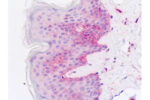 Human Skin: Formalin-Fixed, Paraffin-Embedded (FFPE) (Cadherin 13 antibody  (AA 146-174))