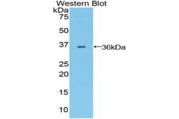 DISP1 anticorps  (AA 1141-1435)