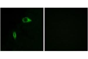 Immunofluorescence (IF) image for anti-Collagen, Type XIV, alpha 1 (COL14A1) (AA 71-120) antibody (ABIN2889924)