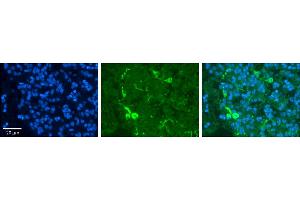 Rabbit Anti-PRDX2 Antibody     Formalin Fixed Paraffin Embedded Tissue: Human Pineal Tissue  Observed Staining: Cytoplasmic in cell bodies and processes of pinealocytes  Primary Antibody Concentration: 1:100  Other Working Concentrations: 1/600  Secondary Antibody: Donkey anti-Rabbit-Cy3  Secondary Antibody Concentration: 1:200  Magnification: 20X  Exposure Time: 0. (Peroxiredoxin 2 antibody  (Middle Region))
