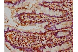 IHC image of ABIN7145194 diluted at 1:200 and staining in paraffin-embedded human small intestine tissue performed on a Leica BondTM system.