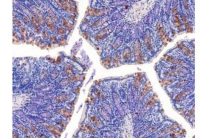 ABIN7094662 and ABIN7098713 at 1/100 staining Rat colorectal tissue by IHC-P. (KCNK10 antibody  (C-Term))