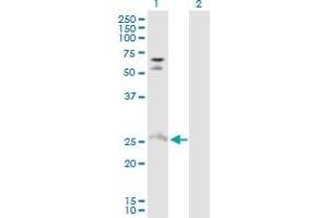 Western Blot analysis of MYO3A expression in transfected 293T cell line by MYO3A MaxPab polyclonal antibody. (MYO3A antibody  (AA 1-247))