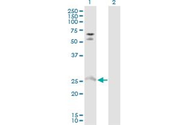 MYO3A anticorps  (AA 1-247)