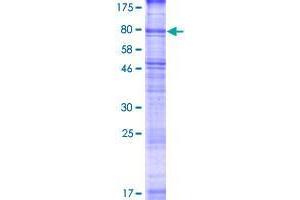 SVOP Protein (AA 1-548) (GST tag)