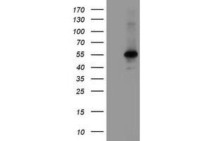 Image no. 1 for anti-Meis Homeobox 3 (MEIS3) (AA 1-261) antibody (ABIN1490668) (MEIS3 antibody  (AA 1-261))