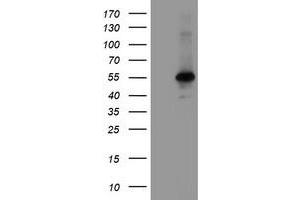 Image no. 1 for anti-Meis Homeobox 3 (MEIS3) (AA 1-261) antibody (ABIN1490668)