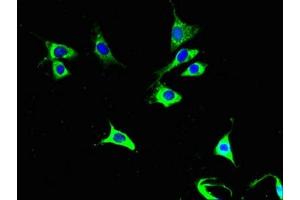 Immunofluorescent analysis of NIH/3T3 cells using ABIN7149175 at dilution of 1:100 and Alexa Fluor 488-congugated AffiniPure Goat Anti-Rabbit IgG(H+L) (COX6A1 antibody  (AA 25-109))