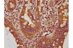 IHC image of ABIN7148519 diluted at 1:200 and staining in paraffin-embedded human small intestine tissue performed on a Leica BondTM system. (Copine III antibody  (AA 297-442))