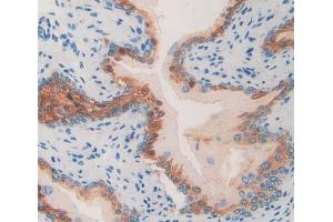 Used in DAB staining on fromalin fixed paraffin- embedded Kidney tissue (HAP1 antibody  (AA 132-328))