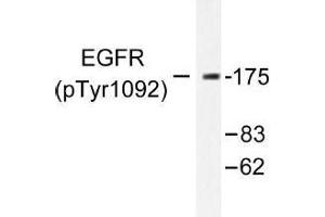 Image no. 1 for anti-Epidermal Growth Factor Receptor (EGFR) (pTyr1092) antibody (ABIN318011) (EGFR antibody  (pTyr1092))