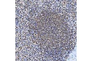 IHC analysis of SNRNP200 using anti-SNRNP200 antibody (ABIN7602032). (SNRNP200 antibody  (AA 557-2129))