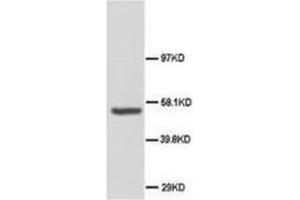 Western blot analysis of rat brain tissue lysis using ABI-1 antibody (ABI1 antibody  (C-Term))