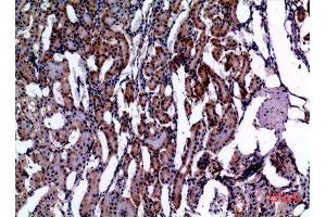 Immunohistochemistry (IHC) image for anti-E2F Transcription Factor 4, P107/p130-Binding (E2F4) antibody (ABIN3187838)