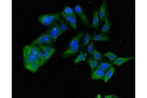 Immunofluorescent analysis of Hela cells using ABIN7172340 at dilution of 1:100 and Alexa Fluor 488-congugated AffiniPure Goat Anti-Rabbit IgG(H+L) (TNIK antibody  (AA 523-714))