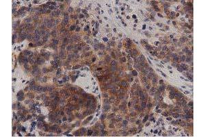 Immunohistochemical staining of paraffin-embedded Human Kidney tissue using anti-PRKD2 mouse monoclonal antibody. (PKD2 antibody)