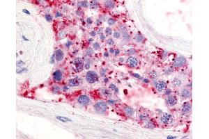 Anti-LPAR5 / GPR92 antibody IHC of human testis, seminiferous tubule. (LPAR5 antibody  (Extracellular Domain))